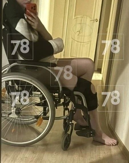 Жительница Петербурга через суд добилась признания бездействия полиции после избиения